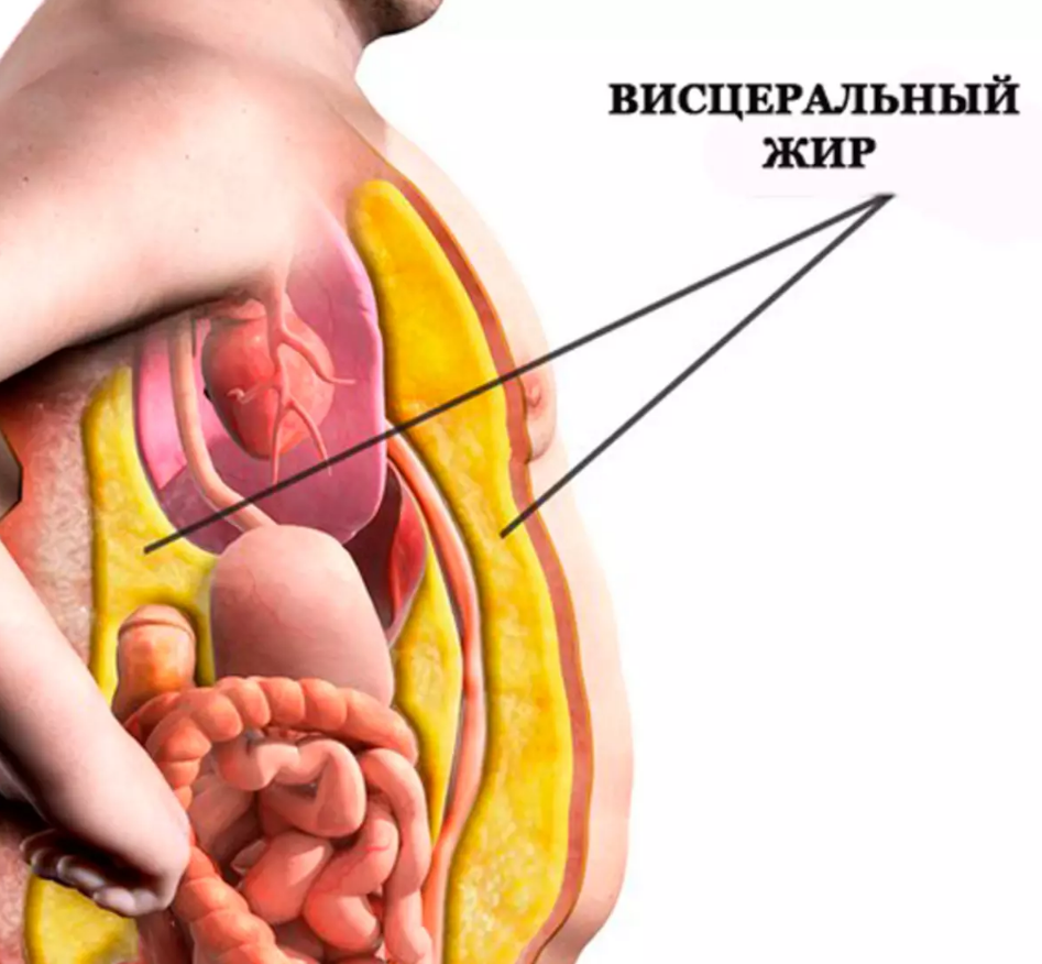 Как эффективно бороться с висцеральным жиром: советы и стратегии